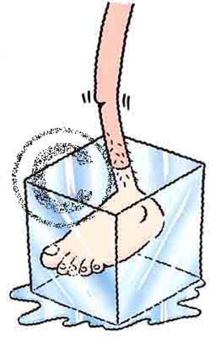 Frozen_feet