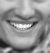 Dents_de_loup