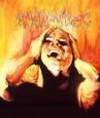 Migraine